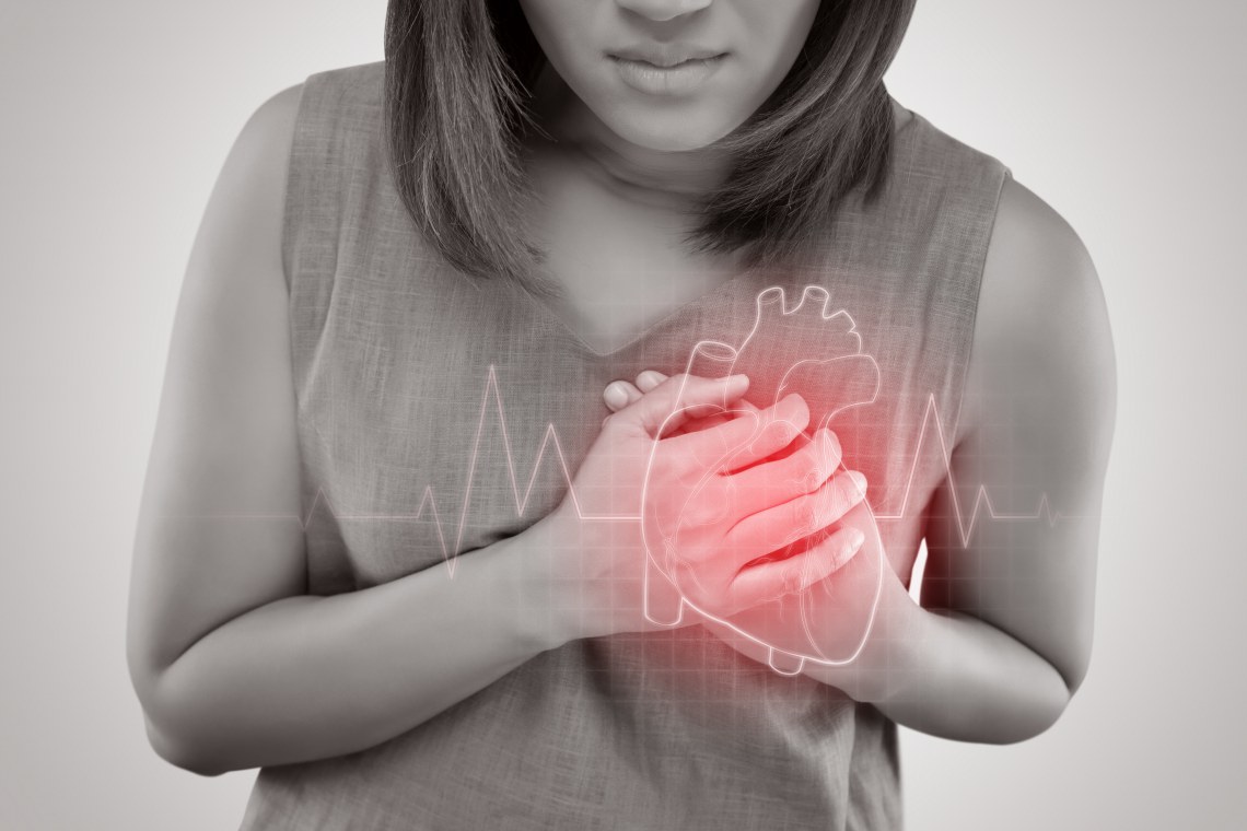 Heart attack