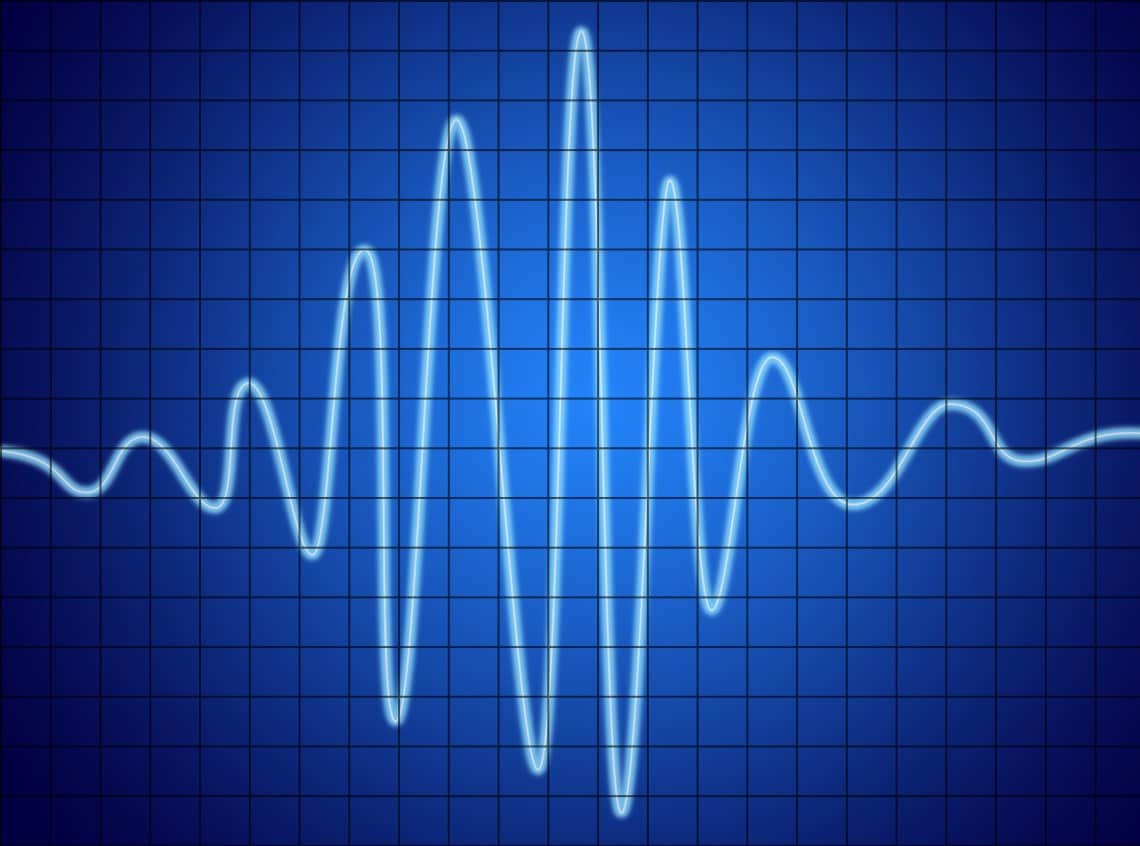 Azure IoT Heart Rate Monitor
