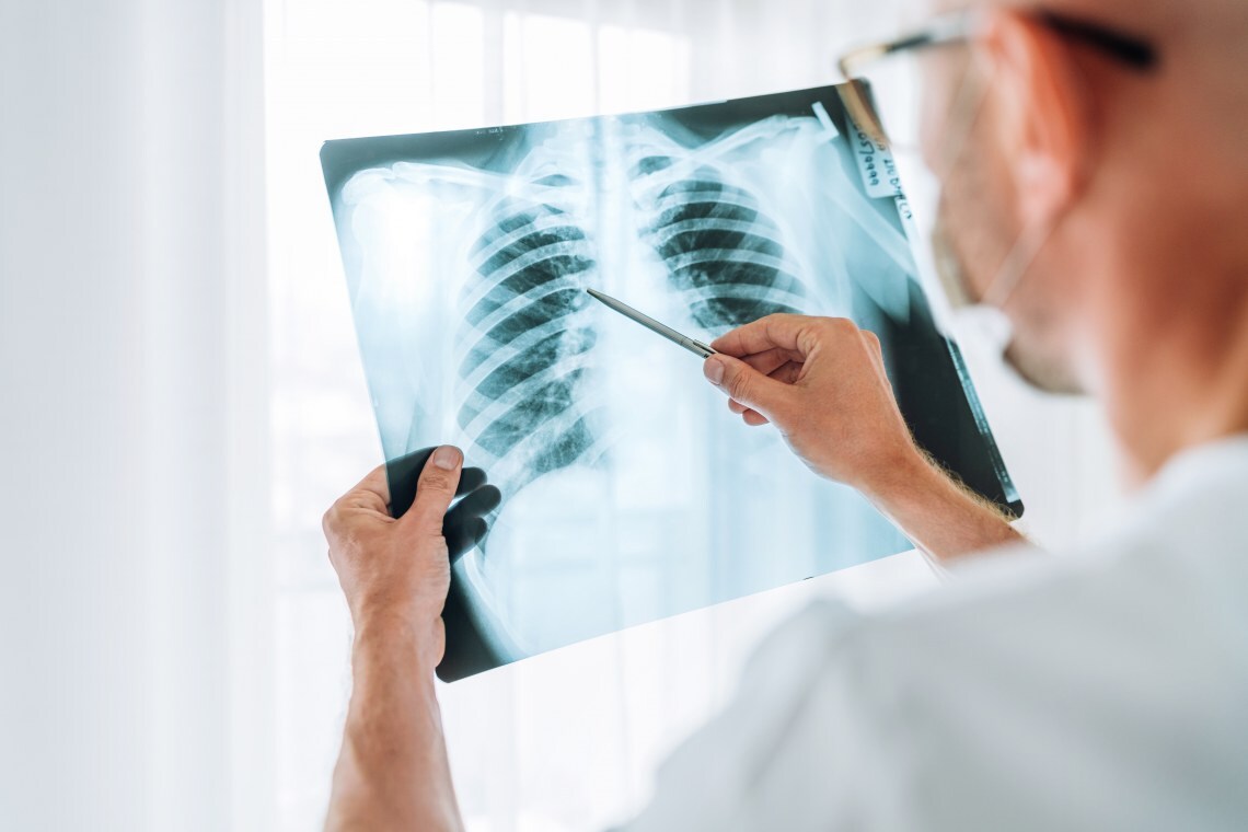 X-Ray Design Solutions