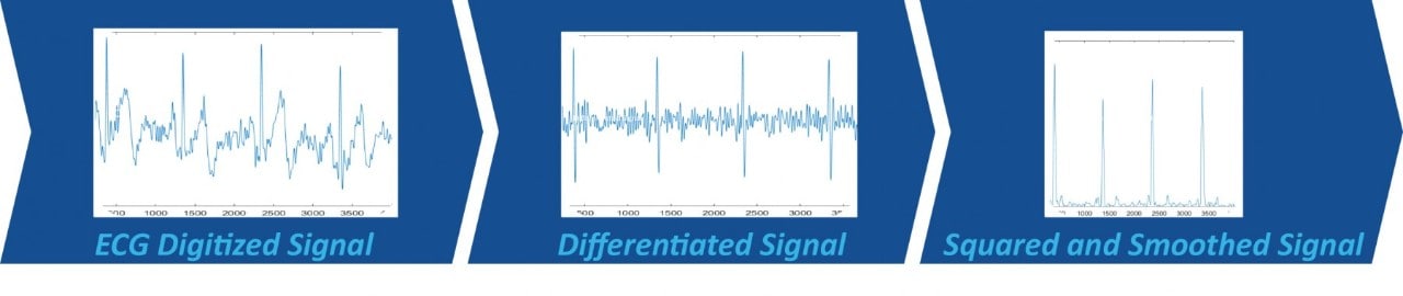 QRS Detection Algorithm