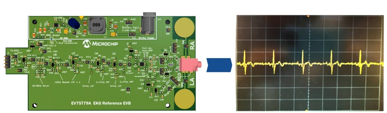 ECG Analog Front-End